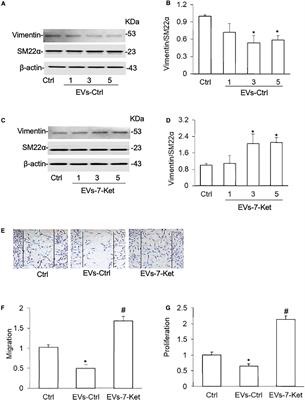Reversal of Endothelial Extracellular Vesicle-Induced Smooth Muscle Phenotype Transition by Hypercholesterolemia Stimulation: Role of NLRP3 Inflammasome Activation